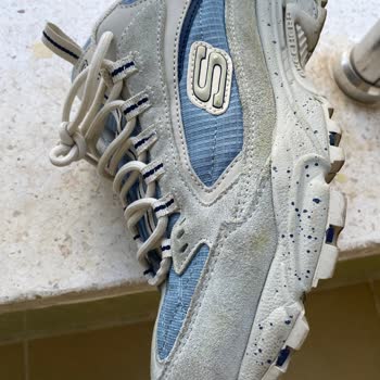 Skechers'tan Aldığım Ayakkabı Kısa Sürede Deforme Oldu, Müşteri Hizmetleri İlgisiz Kaldı