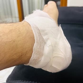 Kalıp Sorunu Yaşadığım Ugg Bot İçin İade Talebime Dönüş Yapılmıyor