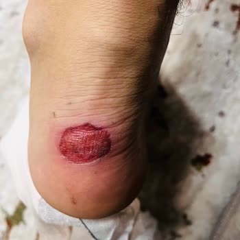 Kalıp Sorunu Yaşadığım Ugg Bot İçin İade Talebime Dönüş Yapılmıyor