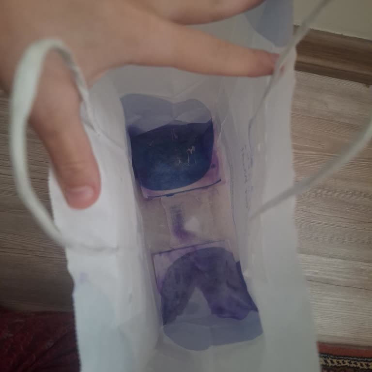 Mad Parfüm Kırık Parfüm Şişesi İçin Mağazalar Arası Çözüm Ve İade Talebim