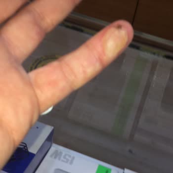 Çalışan Bulaşık Makinesi Bir Anda Yanmaya Başladı Evimizde Panik Ve Hasar Yaşadık