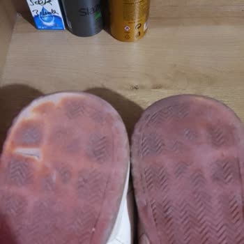 Kısa Sürede Tabanı Parçalanan Ayakkabım İçin Yanlış Arıza Kaydı Açıldı