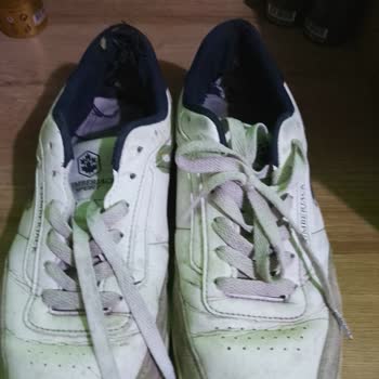 Kısa Sürede Tabanı Parçalanan Ayakkabım İçin Yanlış Arıza Kaydı Açıldı