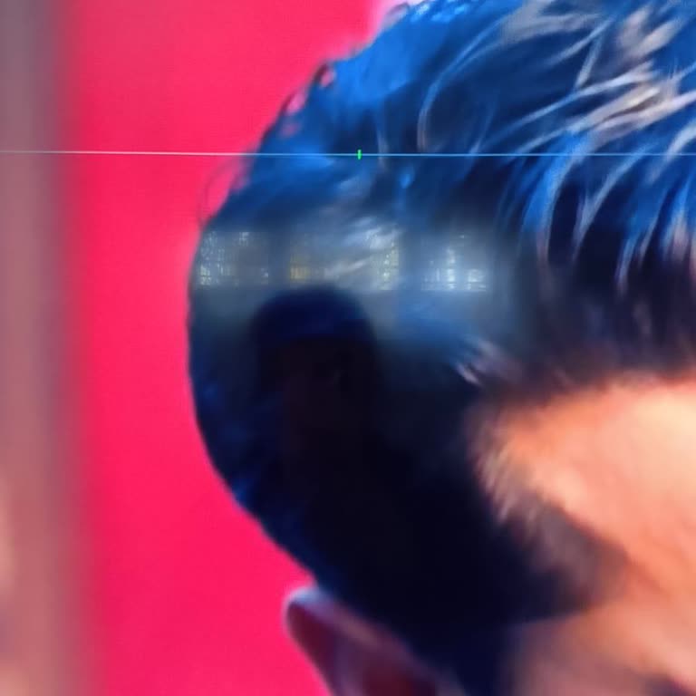 Sunny Webasto Televizyonumda Ekran Sorunu Ve Servis Sürecinde Yaşanan Mağduriyet!