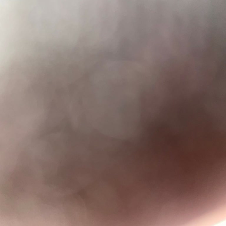 Ziraat Mobil Bankacılıkta Para Transferi Engeliyle Mağduriyet Yaşıyorum