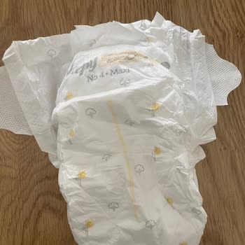 Bebek Bezinde Sert Cisim Şoku: Güvenim Sarsıldı