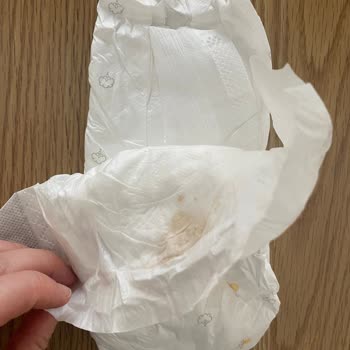 Bebek Bezinde Sert Cisim Şoku: Güvenim Sarsıldı