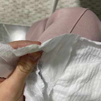 Molfix Bebek Bezinde Sakız Çıkması Nedeniyle Güven Kaybı Ve Sağlık Endişesi