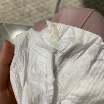 Molfix Bebek Bezinde Sakız Çıkması Nedeniyle Güven Kaybı Ve Sağlık Endişesi