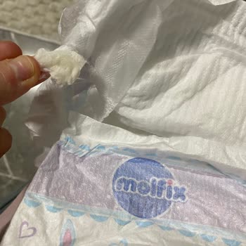 Molfix Bebek Bezinde Sakız Çıkması Nedeniyle Güven Kaybı Ve Sağlık Endişesi