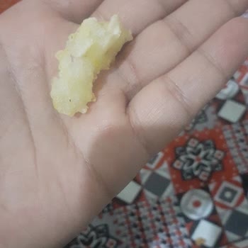 Popeyes Siparişimde Hijyen Skandalı: Taş Gibi Madde Ve Kanlı Tavuk!