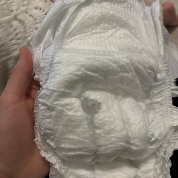 Molfix Bebek Bezinde Paketten Çıkan Siyah Yabancı Madde Hijyen Endişesi Yarattı