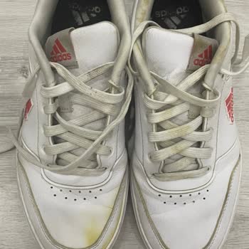 Adidas Ayakkabıda Üretim Kaynaklı Sararma Ve Garanti Sürecinde İlgisizlik Nedeniyle Mağduriyet