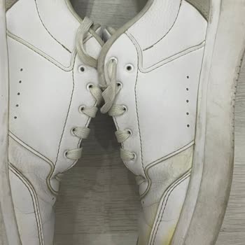 Adidas Ayakkabıda Üretim Kaynaklı Sararma Ve Garanti Sürecinde İlgisizlik Nedeniyle Mağduriyet