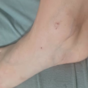 Satın Aldığım Ayakkabı İlk Kullanımda Ciddi Rahatsızlık Verdi, Uzaktan Çözüm Talep Ediyorum