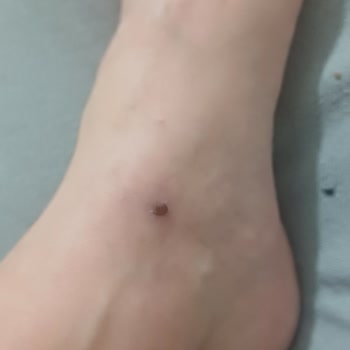 Satın Aldığım Ayakkabı İlk Kullanımda Ciddi Rahatsızlık Verdi, Uzaktan Çözüm Talep Ediyorum