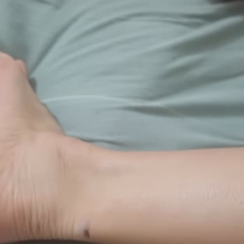 Satın Aldığım Ayakkabı İlk Kullanımda Ciddi Rahatsızlık Verdi, Uzaktan Çözüm Talep Ediyorum