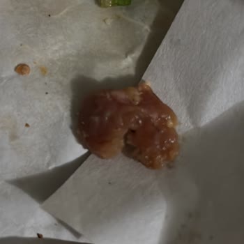 Çiğ Tavuklu Yemekle Karşılaştım, Gıda Güvenliği Riski Yaşadım