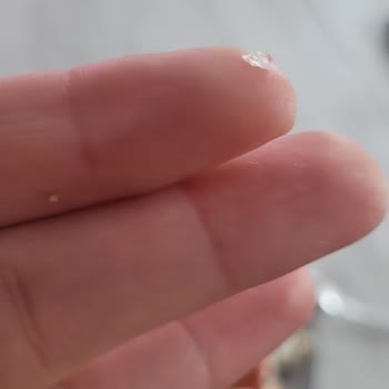 Mantıdan Çıkan Keskin Parça İle Yaşanan Tehlikeli An