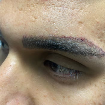 Suit +Plus Güzellik Merkezi’nde Verilen Sözler Tutulmadı, Hem Sağlığım Hem Param Zarar Gördü