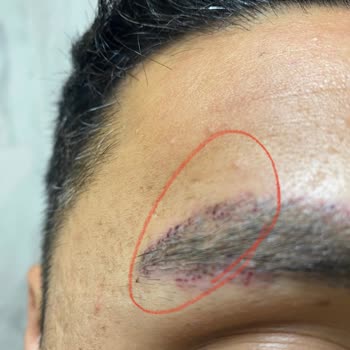 Suit +Plus Güzellik Merkezi’nde Verilen Sözler Tutulmadı, Hem Sağlığım Hem Param Zarar Gördü