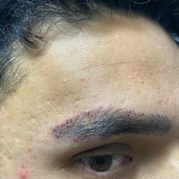 Suit +Plus Güzellik Merkezi’nde Verilen Sözler Tutulmadı, Hem Sağlığım Hem Param Zarar Gördü