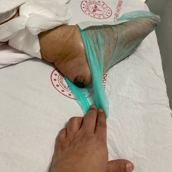 Yoğun Bakımdan Servise Erken Alınan Hastamın Hayatı Tehlikede