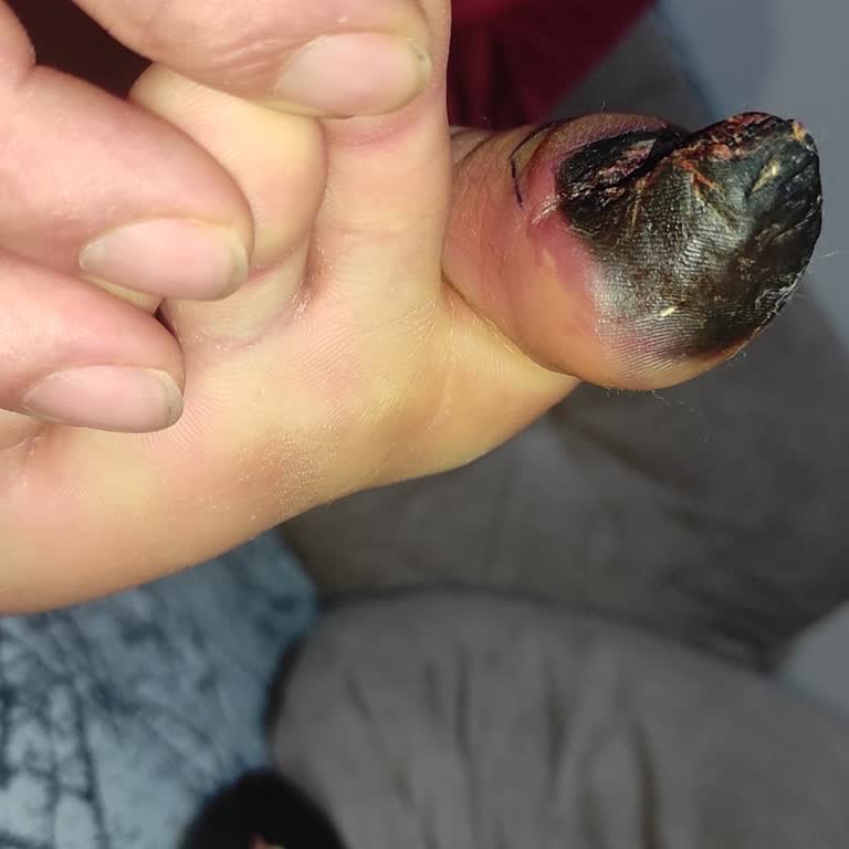 Acil Ameliyat Gereken Durumda Uzun Süreli Randevu Ve Mağduriyet