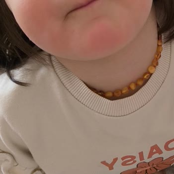 Bebeğimde Ve Bende Ciddi Alerjik Reaksiyon Yapan Dalin Islak Havluya Güvenim Sarsıldı