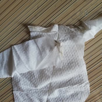 Molfix Bebeklerimiz İçin Aldığımız Islak Mendillerde Hayal Kırıklığı!