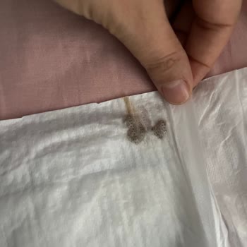 Molfix Bebek Bezinde Tekrar Yabancı Cisim Buldum, Hijyen Ve Güven Endişesi Yaşıyorum