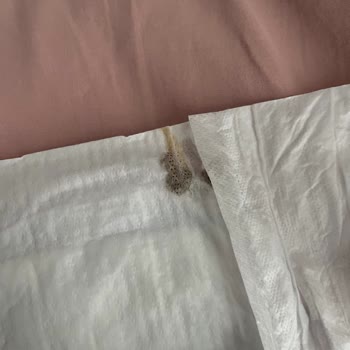 Molfix Bebek Bezinde Tekrar Yabancı Cisim Buldum, Hijyen Ve Güven Endişesi Yaşıyorum