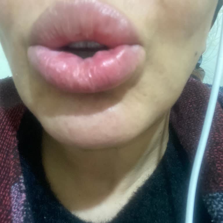 Medica Europe Clinic'te Yapılan Estetik İşlemlerden Memnun Kalmadım, Ücret İadem Reddedildi