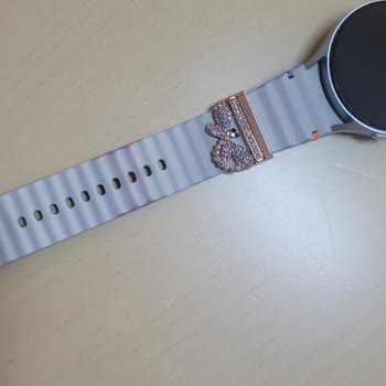 Samsung Telefon Watch 7 Kordonunda 1 Ayda Renk Değişimi Şaşkınlığı!