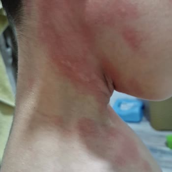 Satın Aldığım Ürünler Sağlık Sorunlarına Yol Açtı, Acil İnceleme Ve İade Talebi