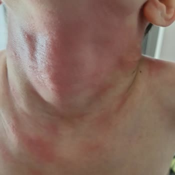 Satın Aldığım Ürünler Sağlık Sorunlarına Yol Açtı, Acil İnceleme Ve İade Talebi