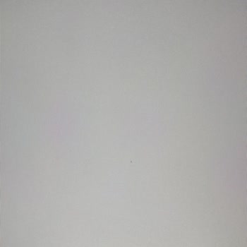 Aynı Üründe İkinci Kez Ölü Piksel Ve Yavaş İade Süreci Mağduriyeti