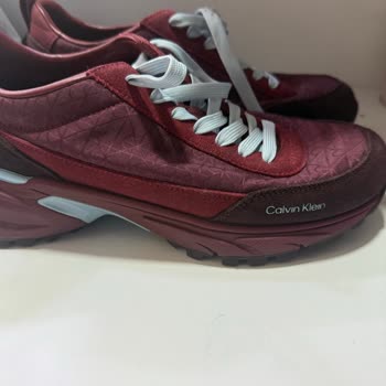 20 Günde Deforme Olan Ayakkabıma Olumsuz İnceleme Sonucu Ve Mağduriyet