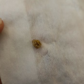 Tukaş Garnitür İçinden Sert Cisim Çıktı, Gıda Güvenliği Endişesi Yaşadım