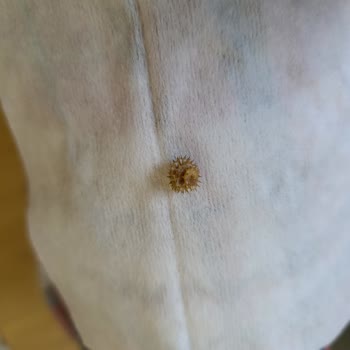 Tukaş Garnitür İçinden Sert Cisim Çıktı, Gıda Güvenliği Endişesi Yaşadım