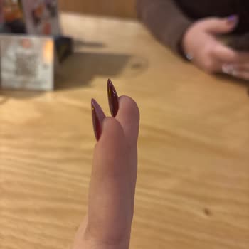 Betül Baş Beauty Kaba Sert Tutum Ve Yapılan Hatalı İşlem