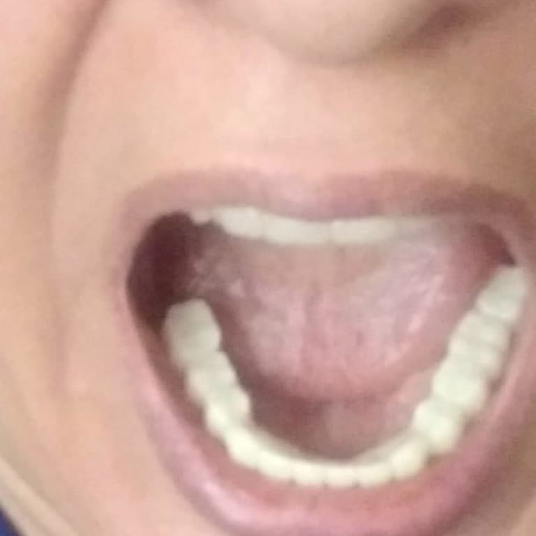 Dental İmplant Clinic İmplant Sürecinde Gecikme, Eksik Uygulama Ve Saygısız Yaklaşım