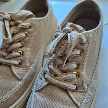 Kısa Sürede Paslanan Ayakkabı İçin İade Talebim Reddedildi