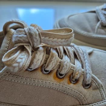 Kısa Sürede Paslanan Ayakkabı İçin İade Talebim Reddedildi