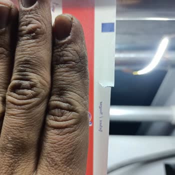 Sürekli Hasarlı Teslimat Ve Sorumluluk Reddi Mağduriyeti