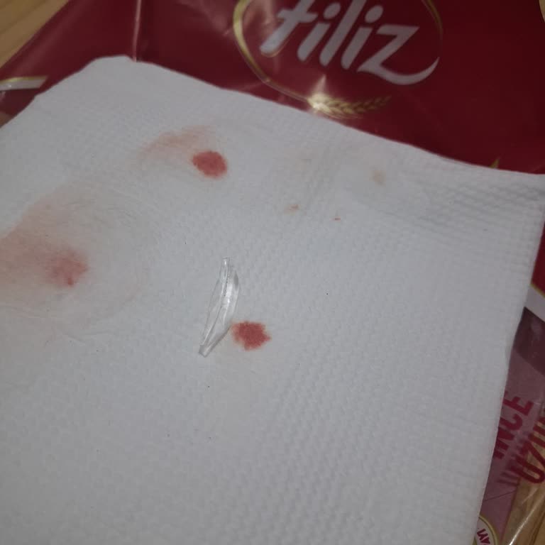 Filiz Makarnanın İçinden Cam Parçası Çıktı, Hayati Tehlike Atlattık