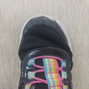 Kısa Sürede Yıpranan Çocuk Ayakkabısına Kullanıcı Hatası Denilmesine İtiraz