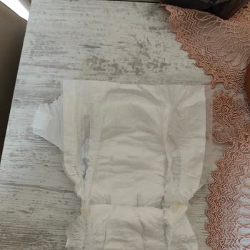 Molfix Bebek Bezlerinde Defolu Ürün Şoku Çocuğumun Sağlığı Riske Girdi