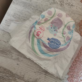 Molfix Bebek Bezlerinde Defolu Ürün Şoku Çocuğumun Sağlığı Riske Girdi