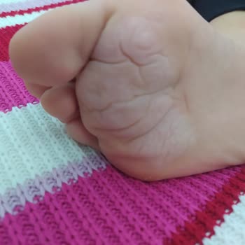 Yeni Alınan Çocuk Botunda Hızlı Deformasyon Ve Uzayan İnceleme Süreci